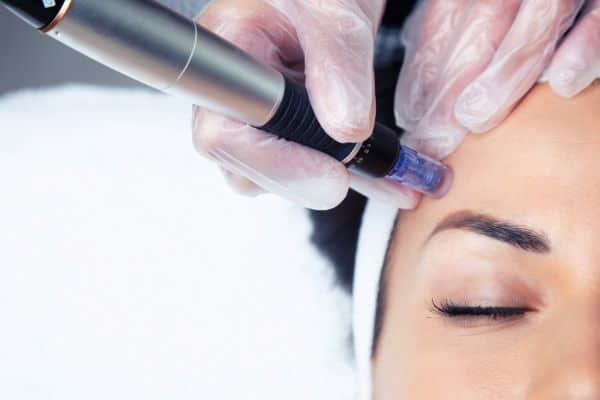 How Often Can You Have Total Skin Tightening Treatment? 2 Why Does the Skin Need Time Between Treatments?
